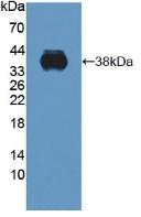 Polyclonal Antibody to C1q And Tumor Necrosis Factor Related Protein 9 (C1QTNF9)