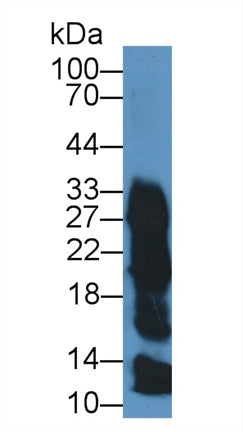 Polyclonal Antibody to Zymogen Granule Protein 16 Homolog B (ZG16B)