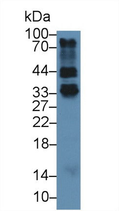 Polyclonal Antibody to Folate Receptor 4 (FOLR4)