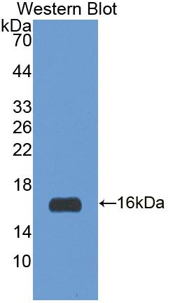 Polyclonal Antibody to Insulin Receptor Substrate 3 (IRS3)