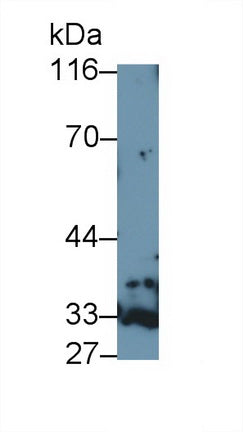 Polyclonal Antibody to Galectin 9B (GAL9B)