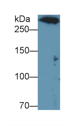 Polyclonal Antibody to Dynein Heavy Chain Domain Containing Protein 1 (DNHD1)