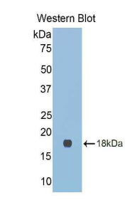 Polyclonal Antibody to Galectin 9C (GAL9C)
