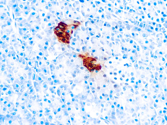 Pancreatic Polypeptide