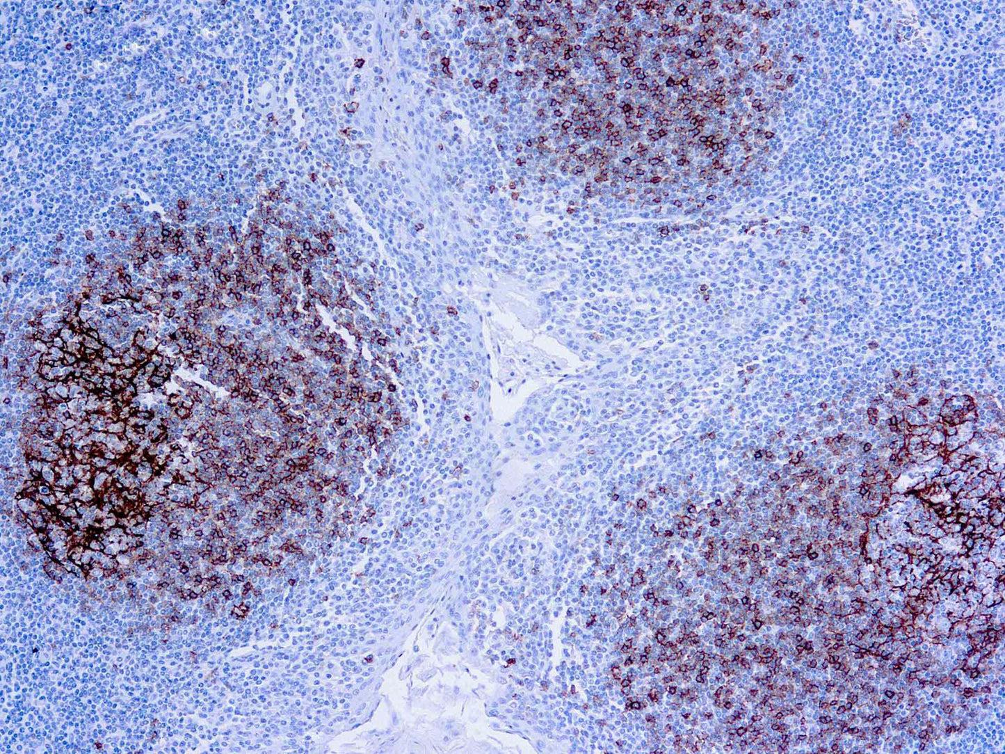 CD23, B Cell