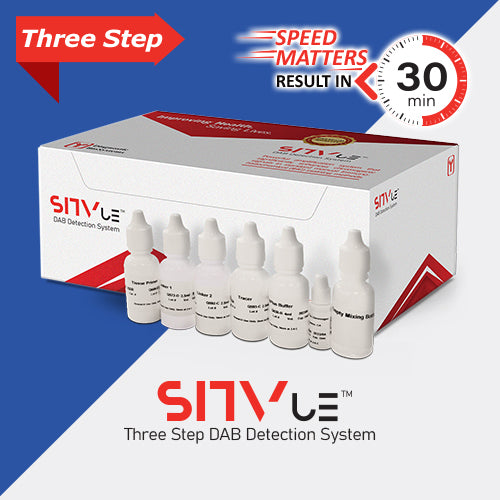 SITvueTM /DAB Detection System