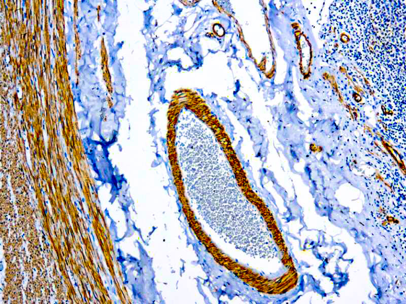 Smooth Muscle Myosin