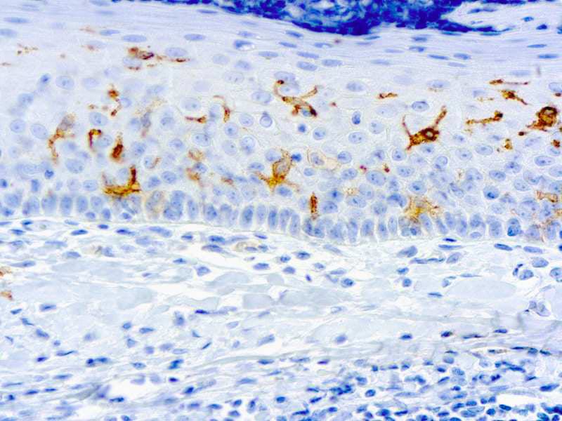 CD1a Cortical Thymocytes