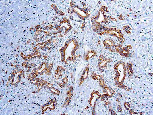 Vascular Endothelial Growth Factor(VEGF)