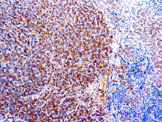 Alpha-1-antitrypsin