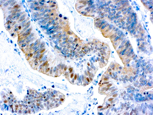 BRCA1