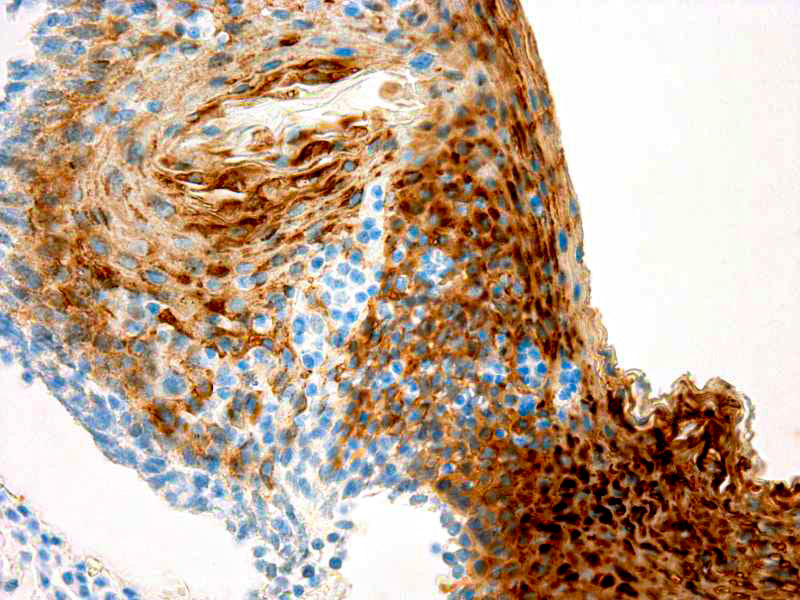 Cytokeratin 13