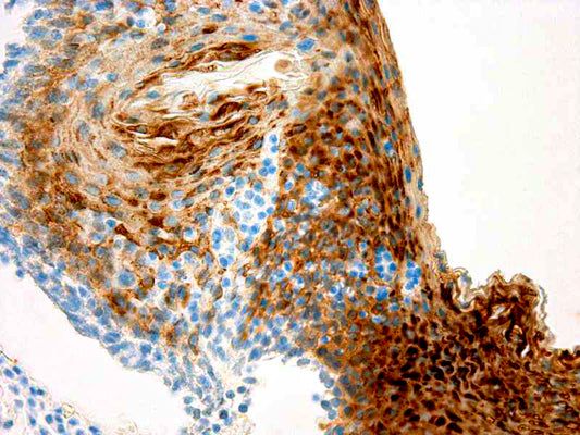 Cytokeratin 13