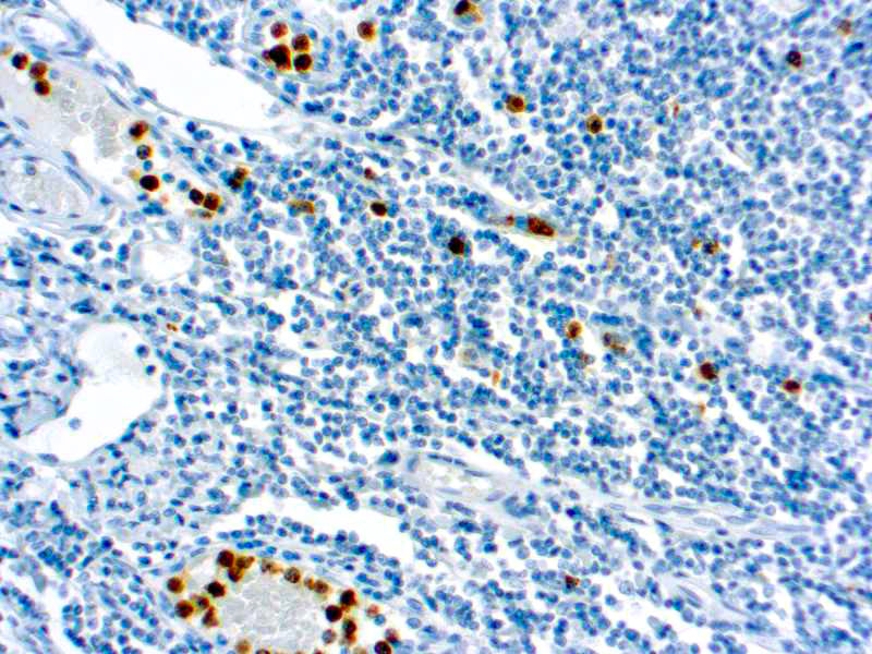 Myeloperoxidase