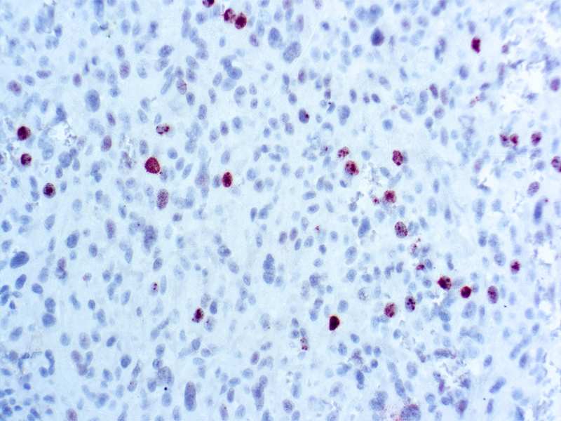 Phosphohistone H3 (PHH3)