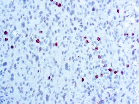 Phosphohistone H3 (PHH3)