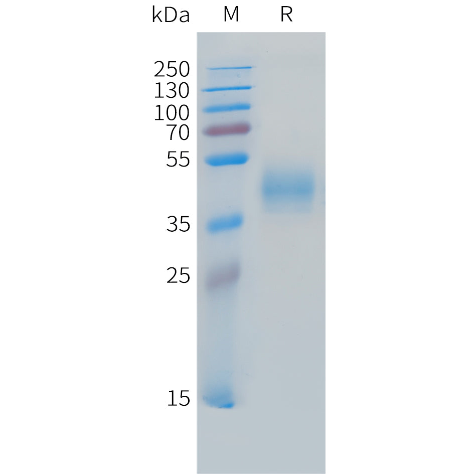 Cynomolgus MICB Protein, His Tag