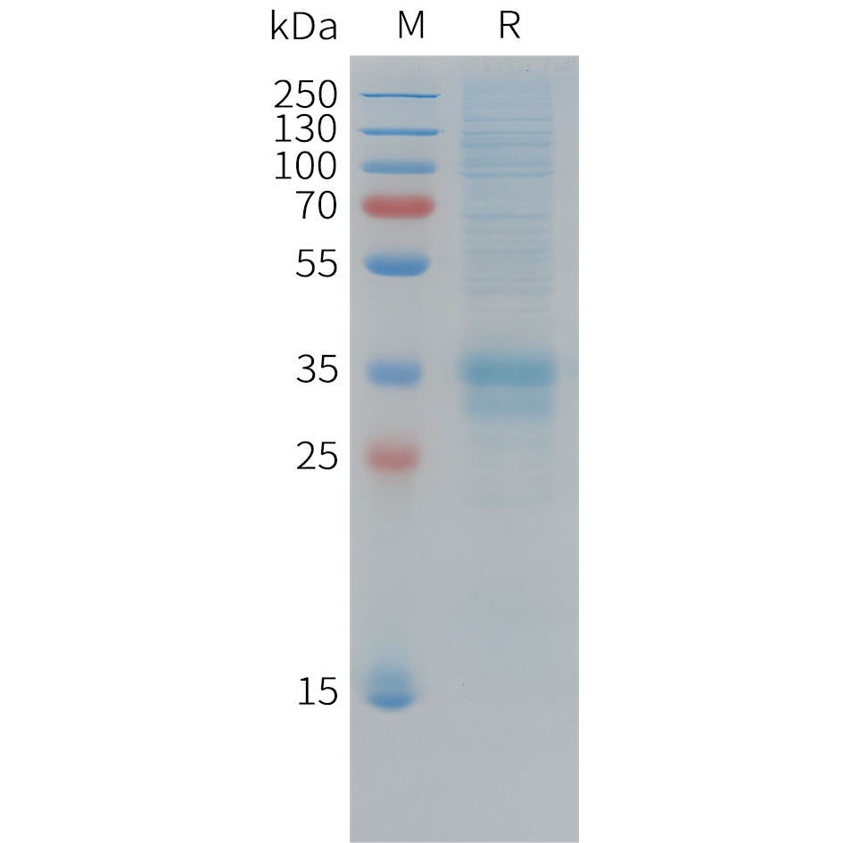 Cynomolgus FOLR1 Protein, His Tag