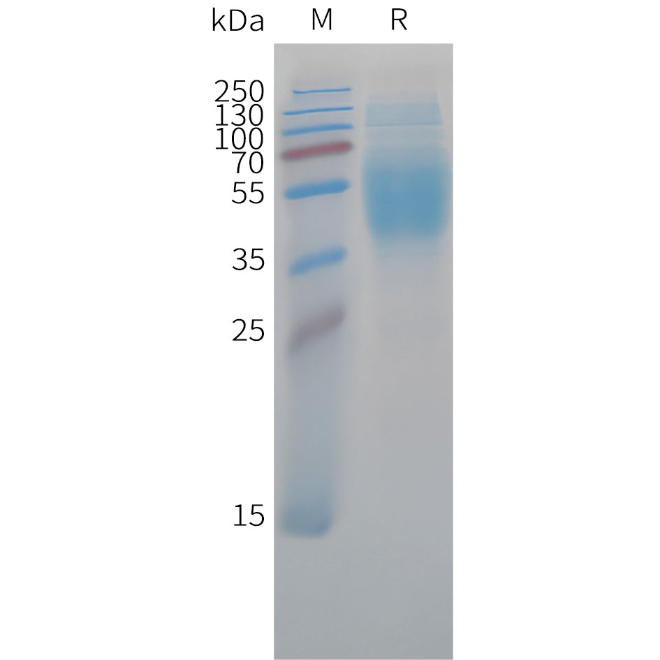 Cynomolgus B7-H4 Protein, His Tag