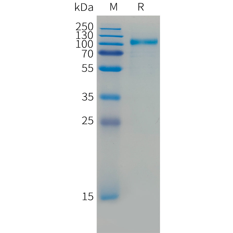 Cynomolgus HER3 Protein, His Tag