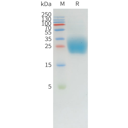 Canine PD-1 Protein, His Tag