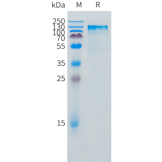 Feline IL31RA Protein, mFc Tag