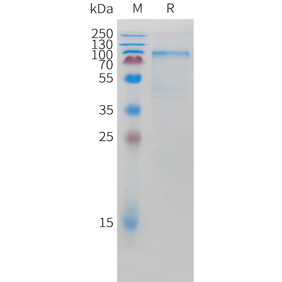 Mouse CDH6 Protein, His Tag