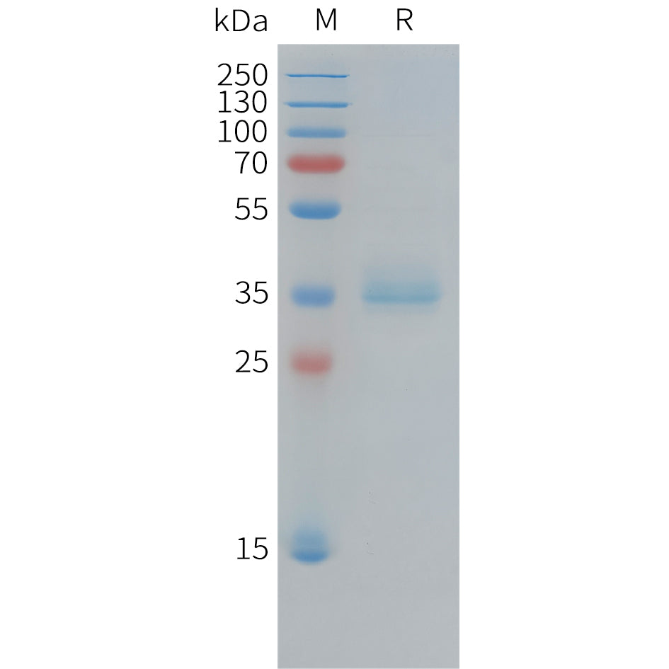 Human KI67(1206-1238) Protein, hFc Tag