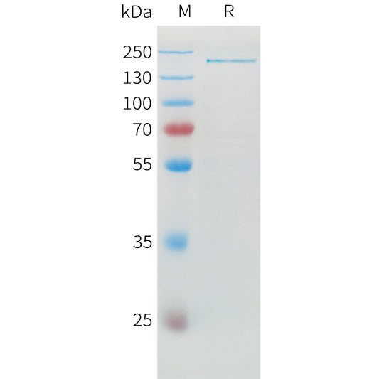 Human ADAMTS13 Protein, His Tag