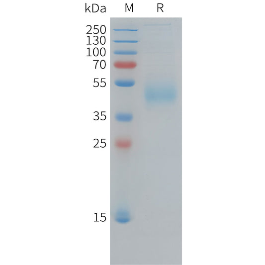 Human CD33(18-259) Protein, His Tag