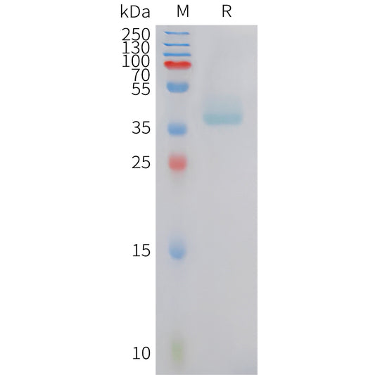 Human BDKRB2 Protein, hFc Tag