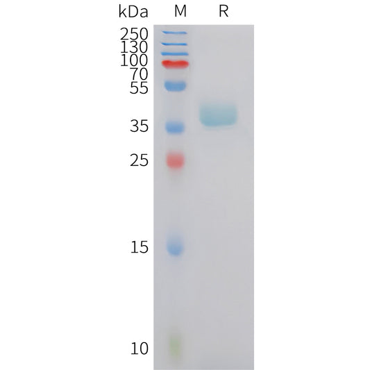 Human CXCR6 Protein, hFc Tag