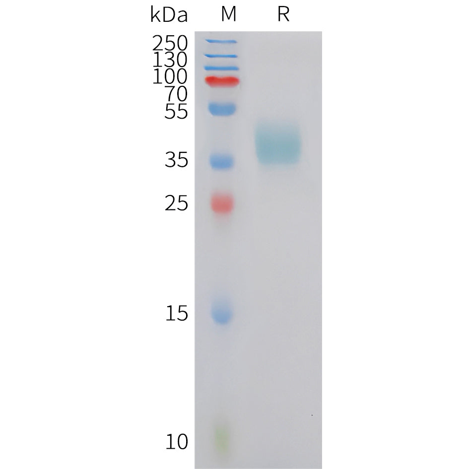 Human CRTH2 Protein, hFc Tag