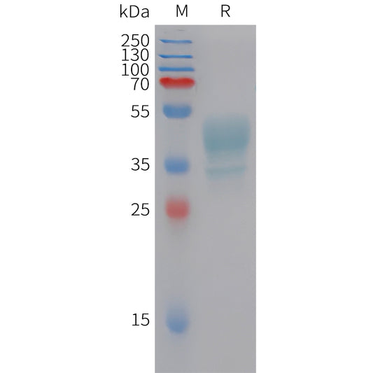 Human CMKLR1 Protein, hFc Tag