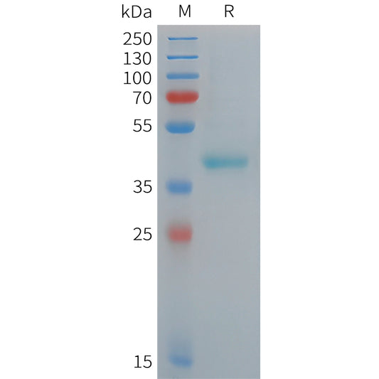 Human CD209 Protein, His Tag