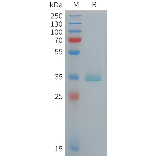 Human APOE Protein, His Tag