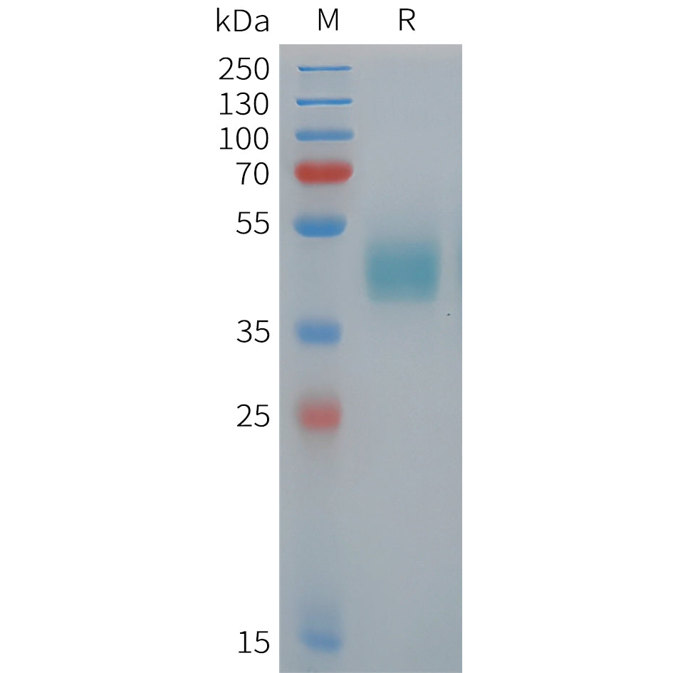 Human ROR1(838-937) Protein, hFc Tag