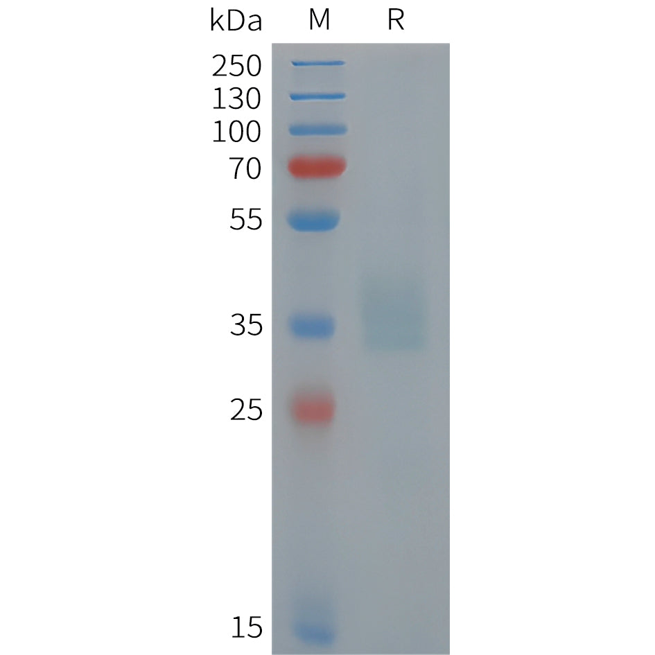 Human POMC Protein, His Tag