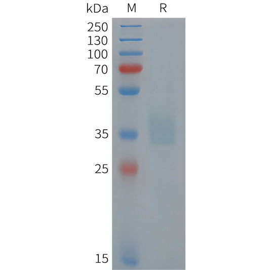 Human POMC Protein, His Tag