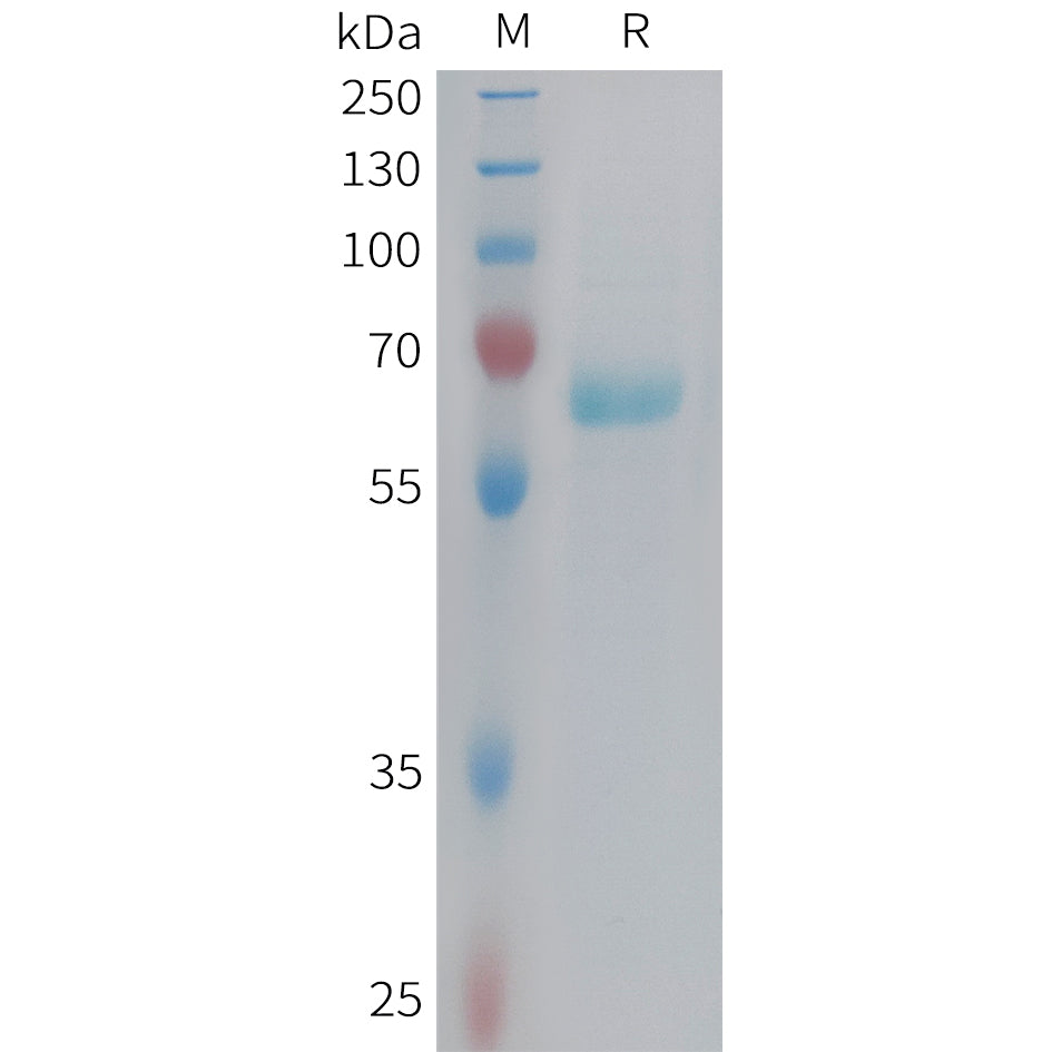 Human EPHB3 Protein, His Tag