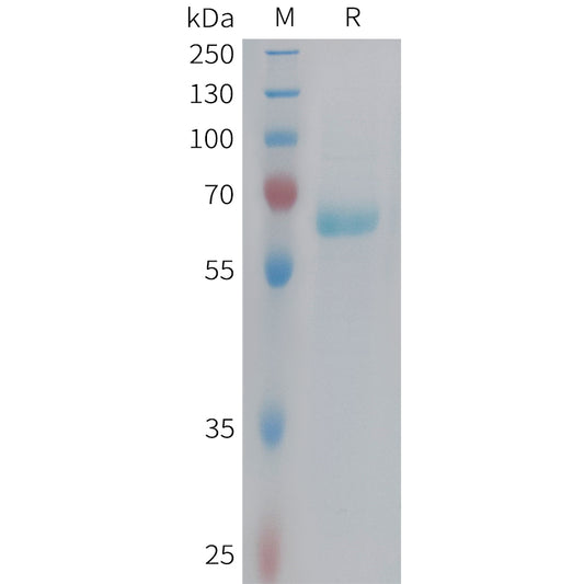 Human EPHB3 Protein, His Tag