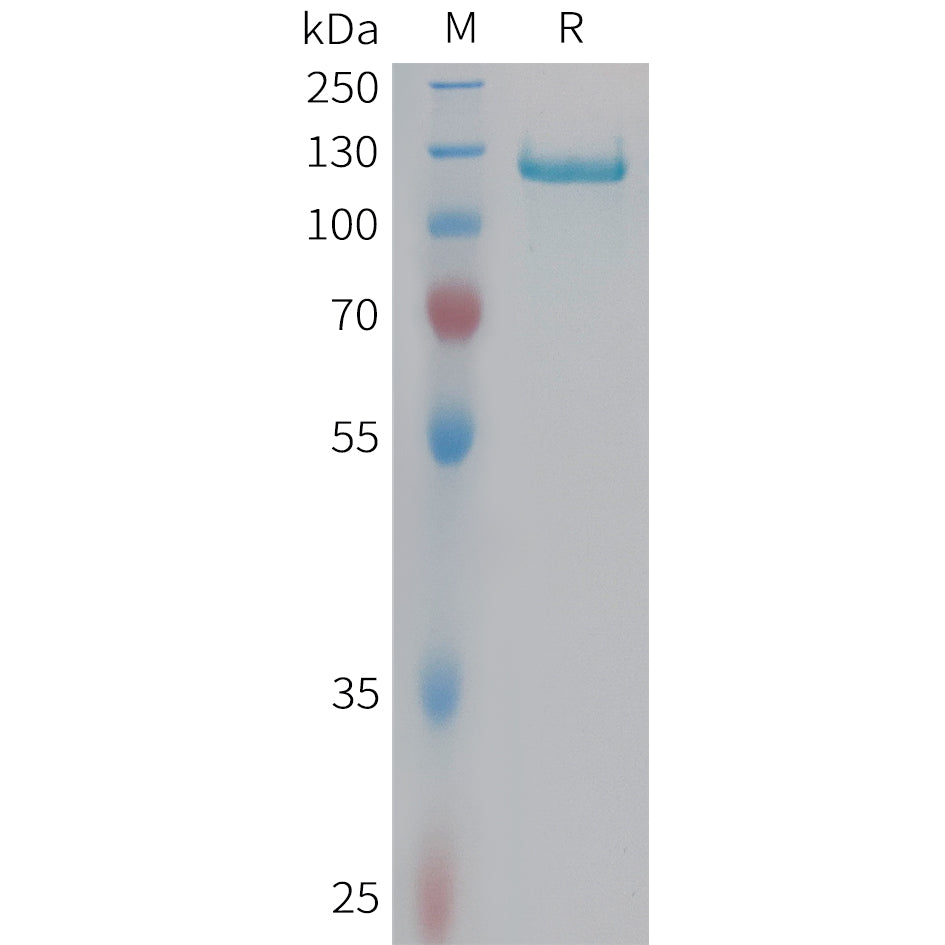 Human C6 Protein, His Tag