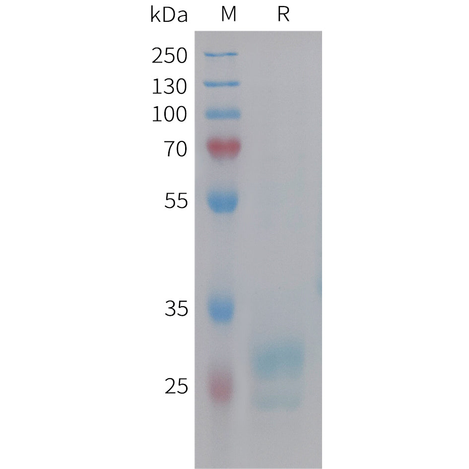 Human HMGB1 Protein, His Tag