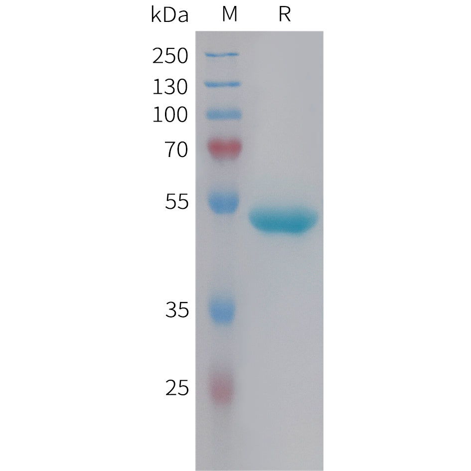 Human NGAL Protein, hFc Tag