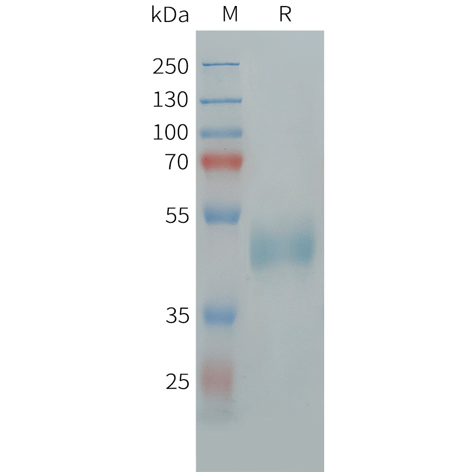 Human FSHB Protein, hFc Tag