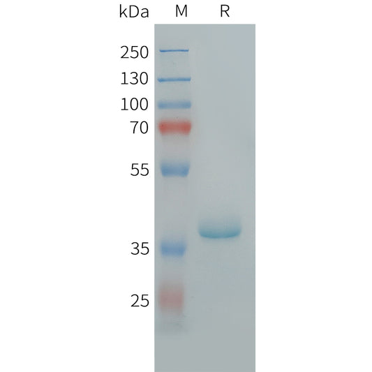 Human CCL17 Protein, hFc Tag