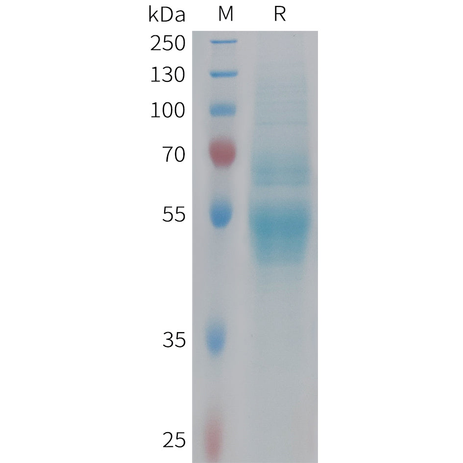 Human F10 Protein, His Tag