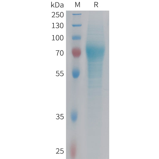 Human F9 Protein, His Tag