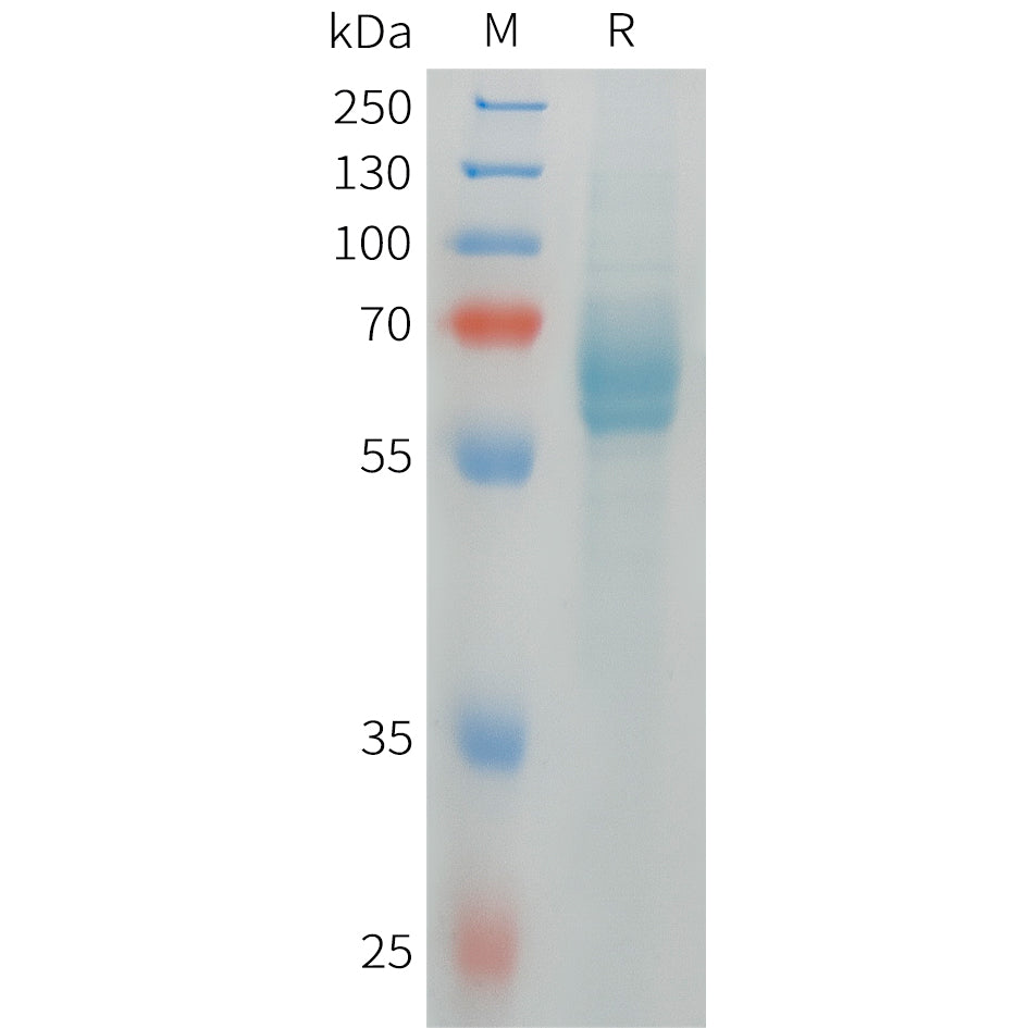 Human DLL4 Protein, His Tag