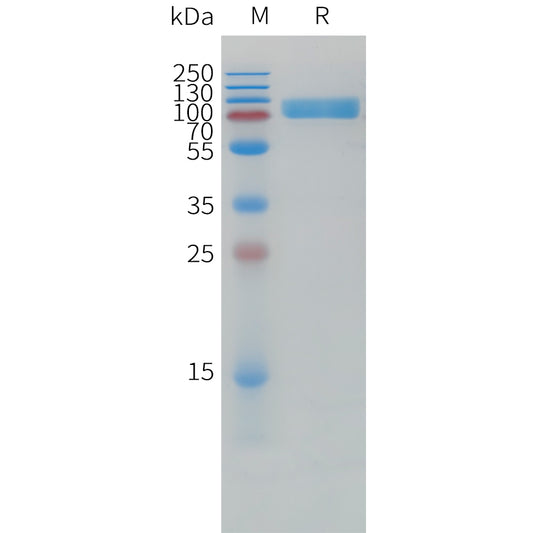 Human IL1RA Protein, mFc Tag